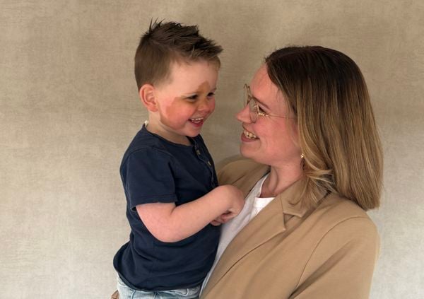 Irma ten Napel over de café-au-laitvlek van haar zoon