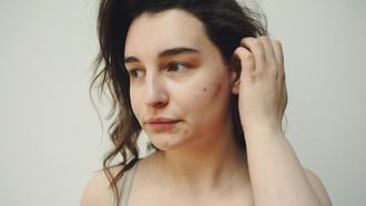 littekens door acne